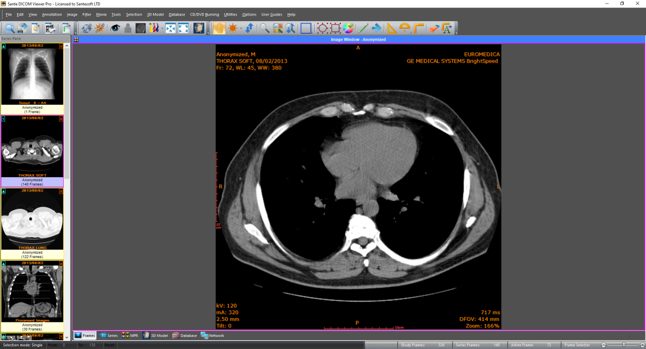 Sante DICOM Viewer Pro crack