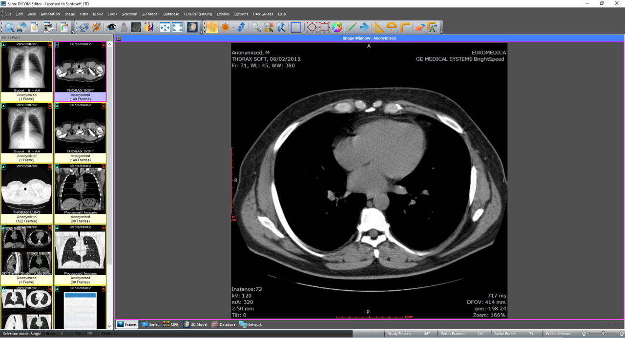 Sante DICOM Editor crack